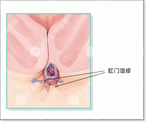 春天菊花痒痒是怎么回事？