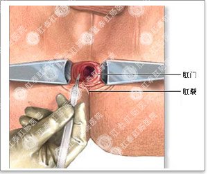 福州肛肠医院