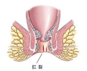 福州肛肠医院